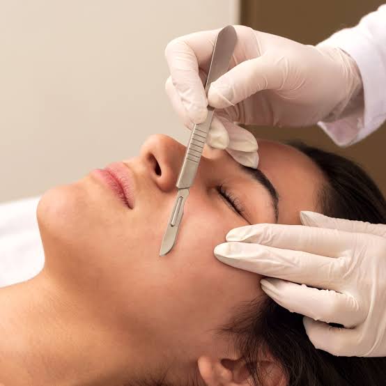 Dermaplaning: Peach Fuzz Removal