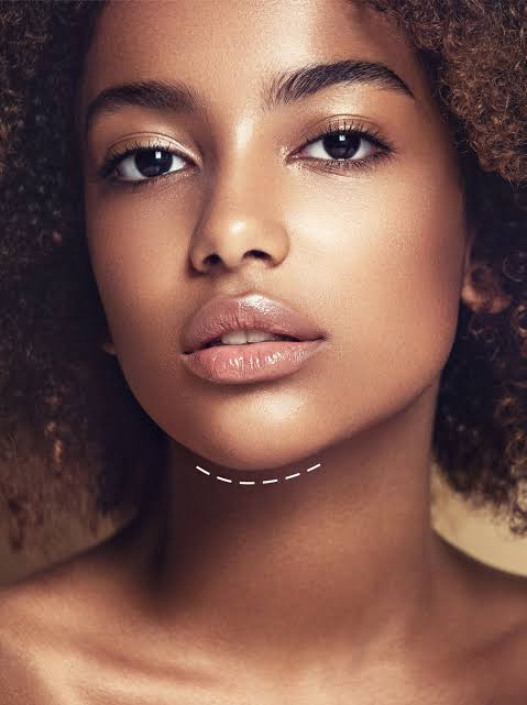 Kybella Double Chin Reduction