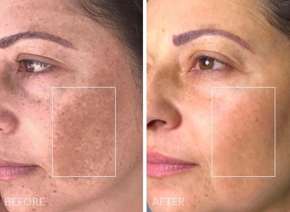Complexion Code Mask