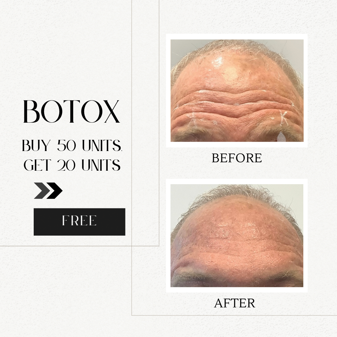 Botox