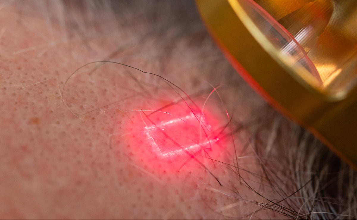 FoLix Laser Hair Regrowth