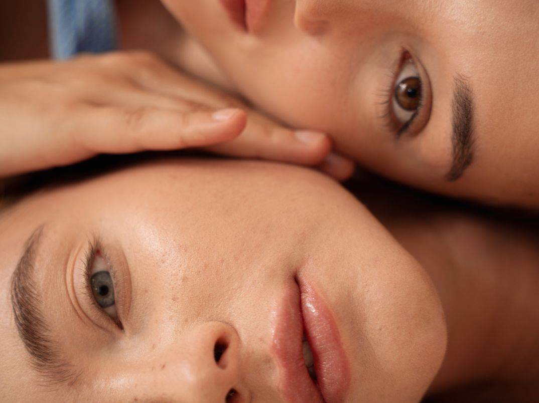 IPL Photofacial for Sun Spots &amp; Redness