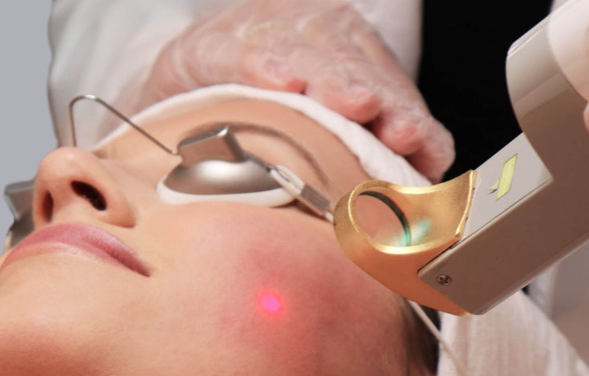 Laser Genesis for Redness &amp; Pores