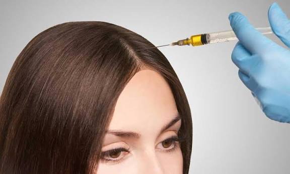 Hair Loss Medication Scalp Injections