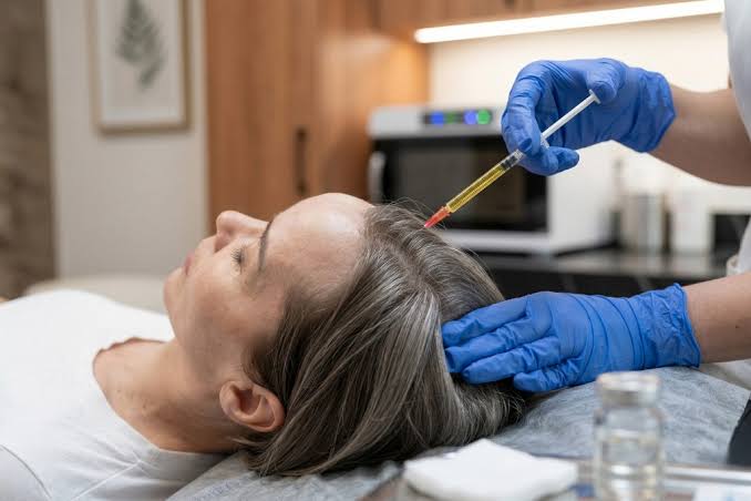 PRP Hair Loss Treatment